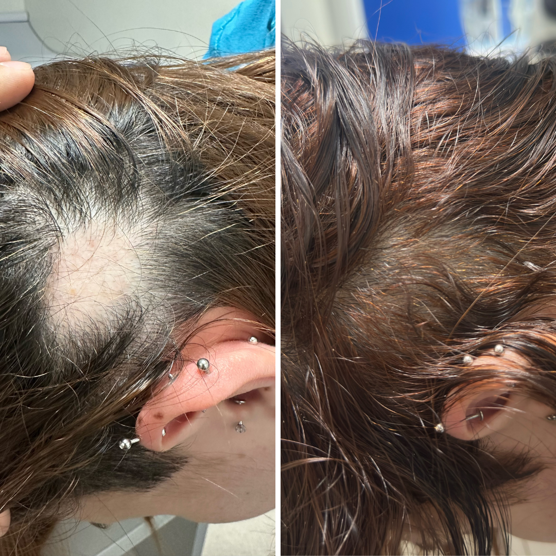 Resultado de tratamento capilar 5 — antes e depois